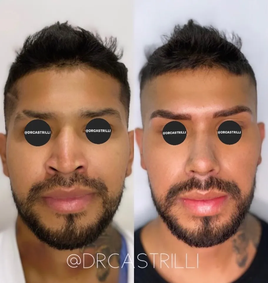 Cirugía Facial